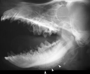 Craniomandibular osteopathy